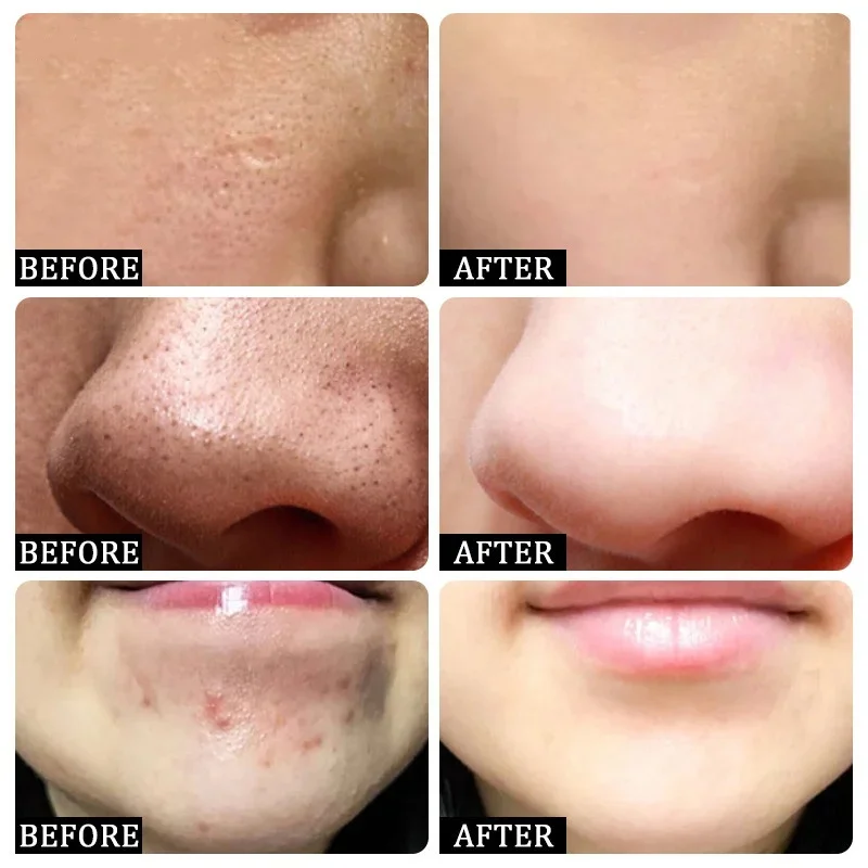 Крем для очищения пор с салици – обзор и цена Korean Skincare Routine