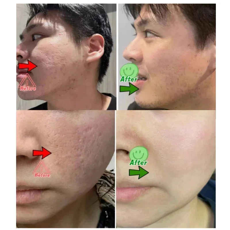 Крем для очищения пор с салици – обзор и цена Korean Skincare Routine