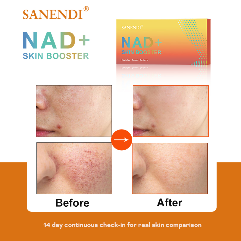 Sanendi NAD+ Корея Средство по – обзор и цена Korean Skincare Routine